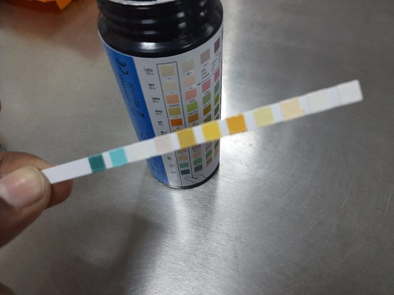 Urine Test Strips and Urinalysis Supplies Wholesale
